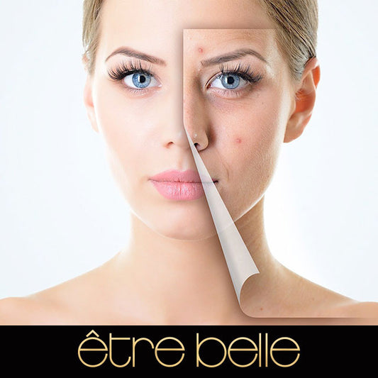 ¿Cómo eliminar la grasa de la cara?